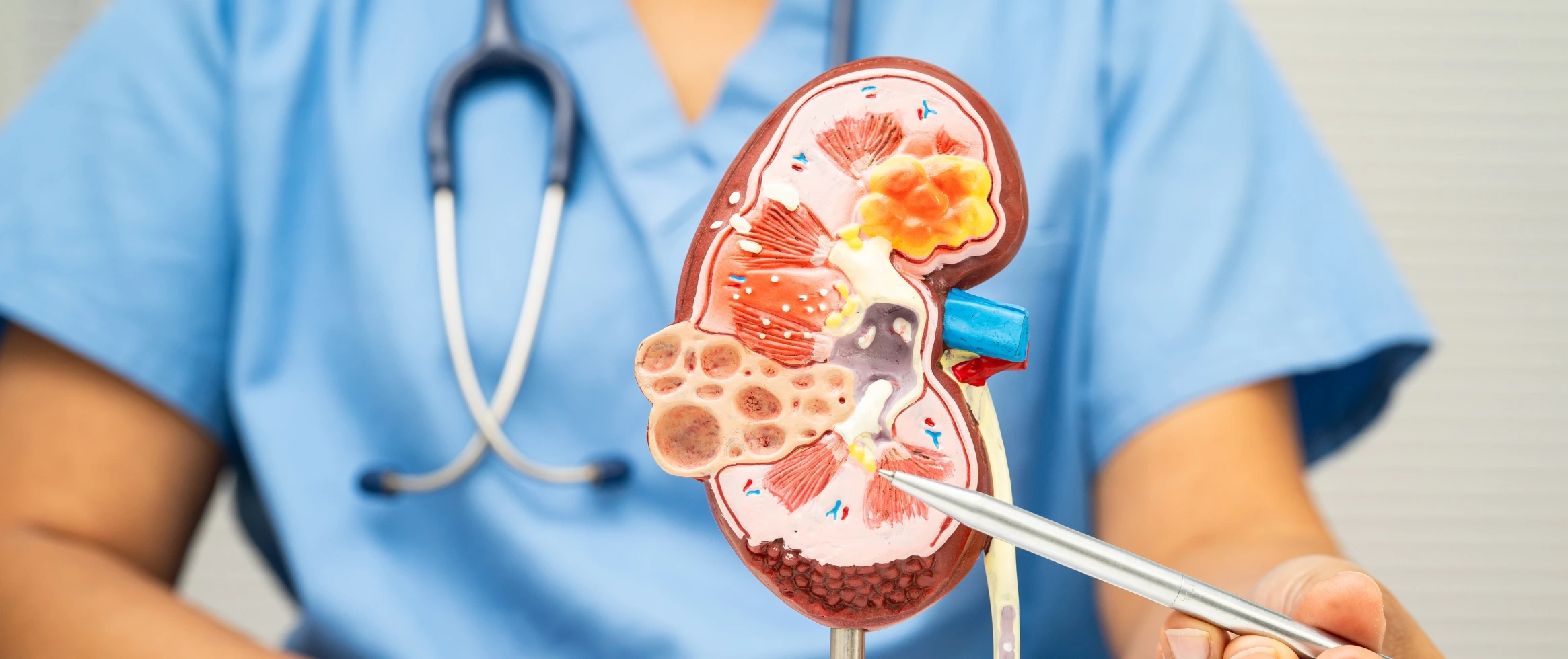 Kidney Failure: Signs, Causes, and Treatment